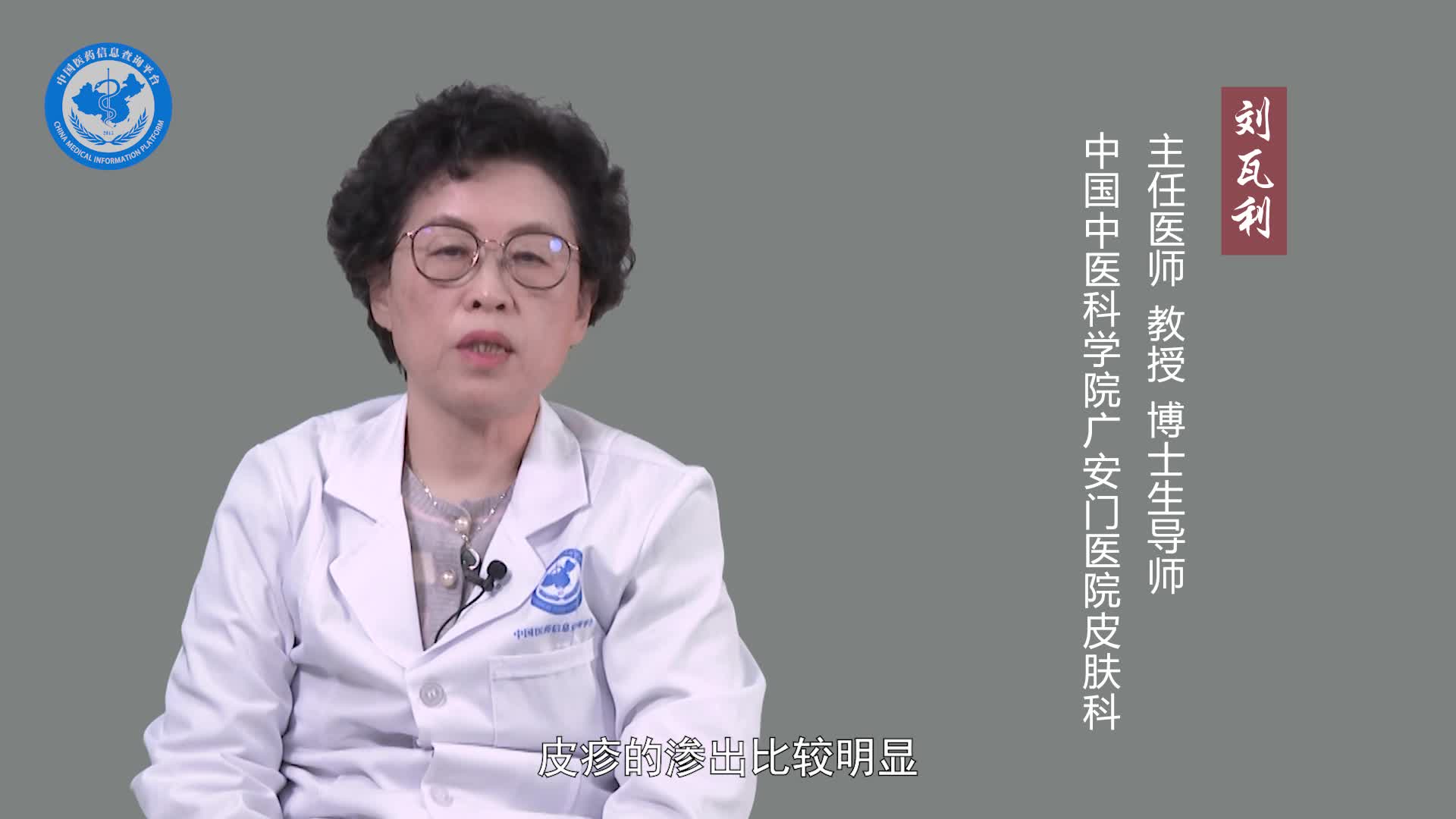 特应性皮炎吃什么药好？