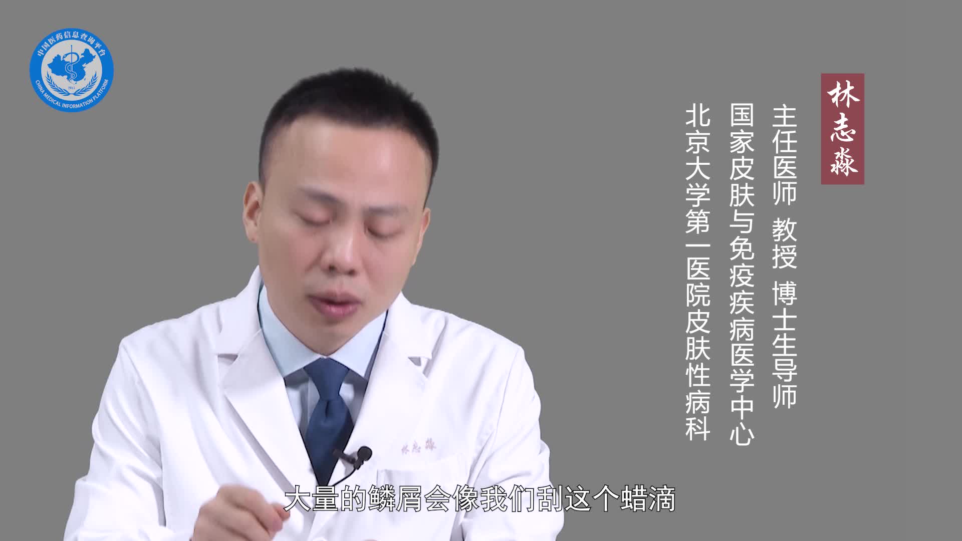 牛皮癣的症状有哪些？