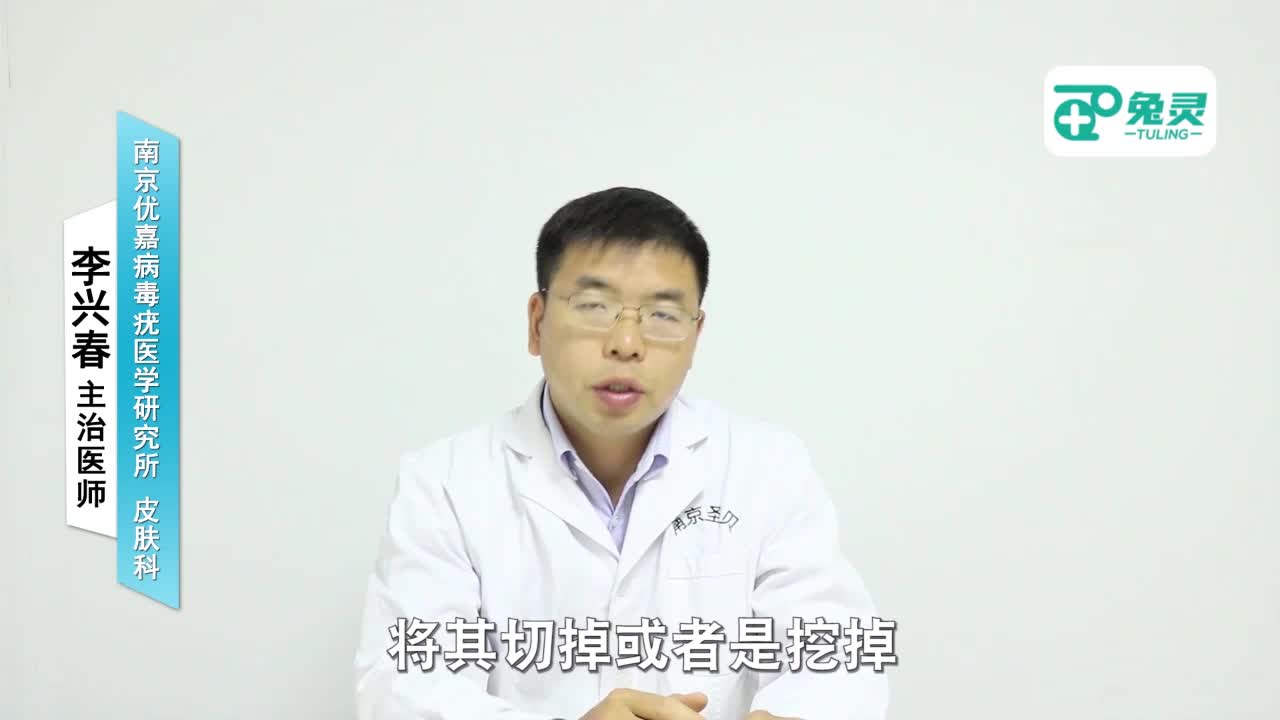 尖锐湿疣的疣体怎么去除