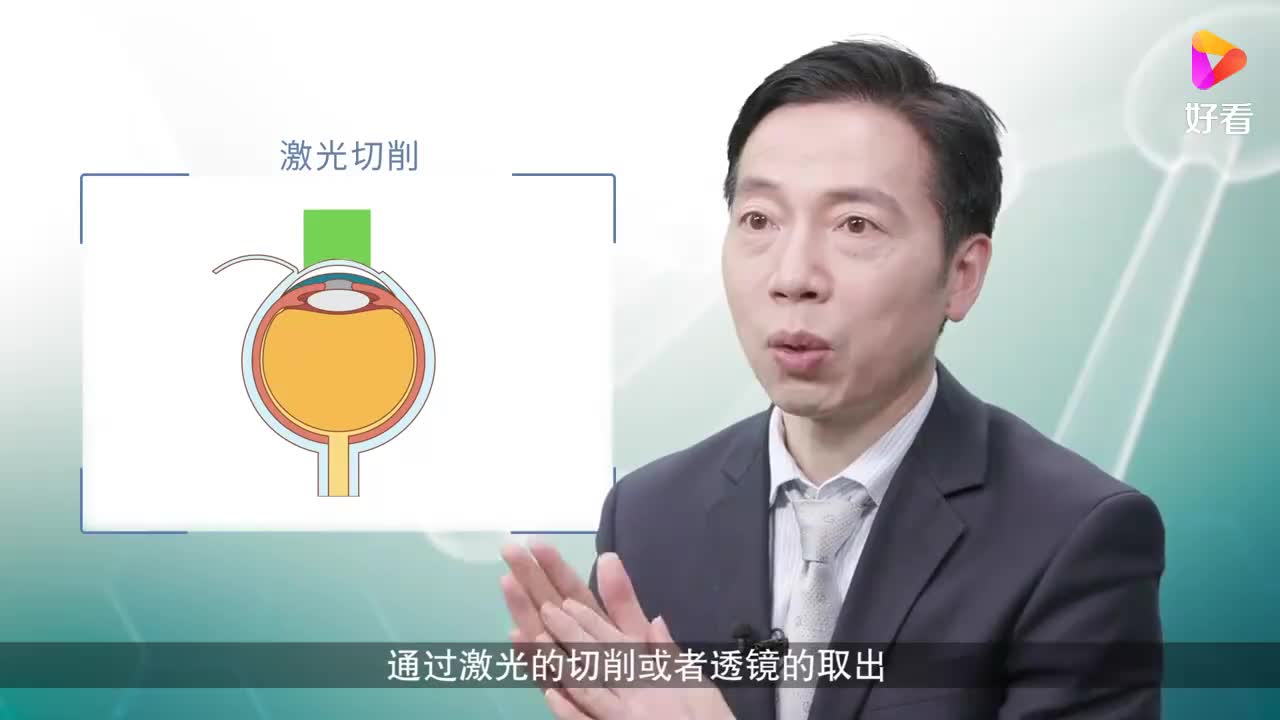 近视手术都有哪些类型
