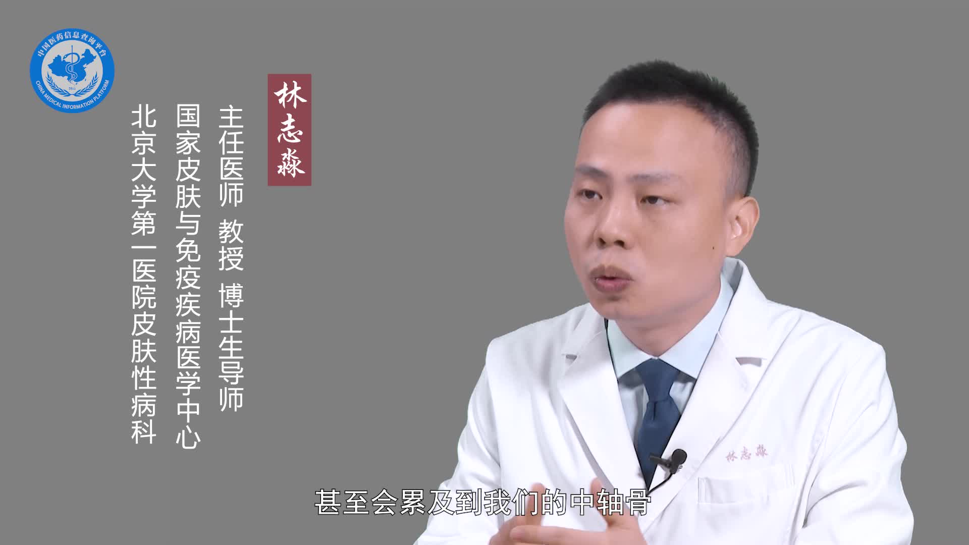 牛皮癣挂什么科？