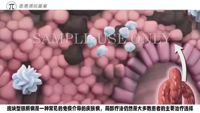 斑块型银屑病新药！FDA批准无类固醇乳膏Zoryve(roflumilast)0.3%